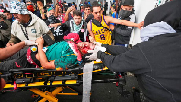 Periodista es herido de gravedad por una granada de gas lacrimógeno en Argentina